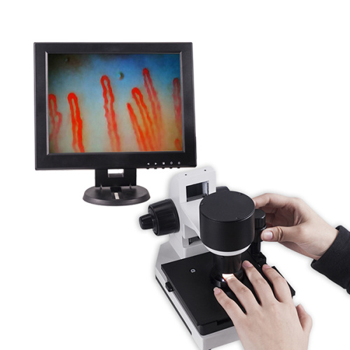 Capillaroscope Vessel Microscope Machine 12 inch LCD for Sale, Capillaroscope Vessel Microscope Machine 12 inch LCD wholesale From China