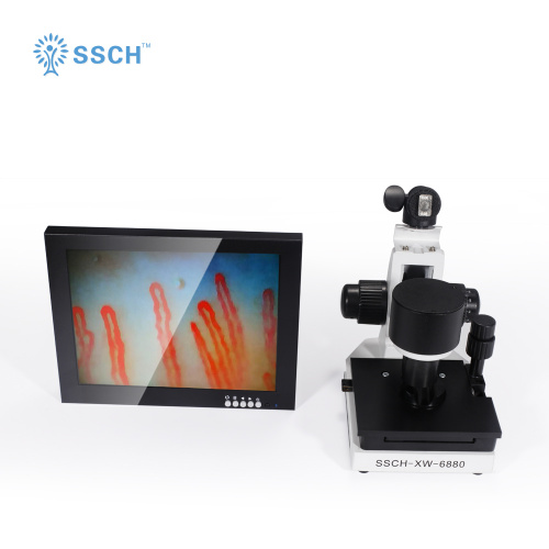 Portable Microscope Microvascular testing equipment for Sale, Portable Microscope Microvascular testing equipment wholesale From China