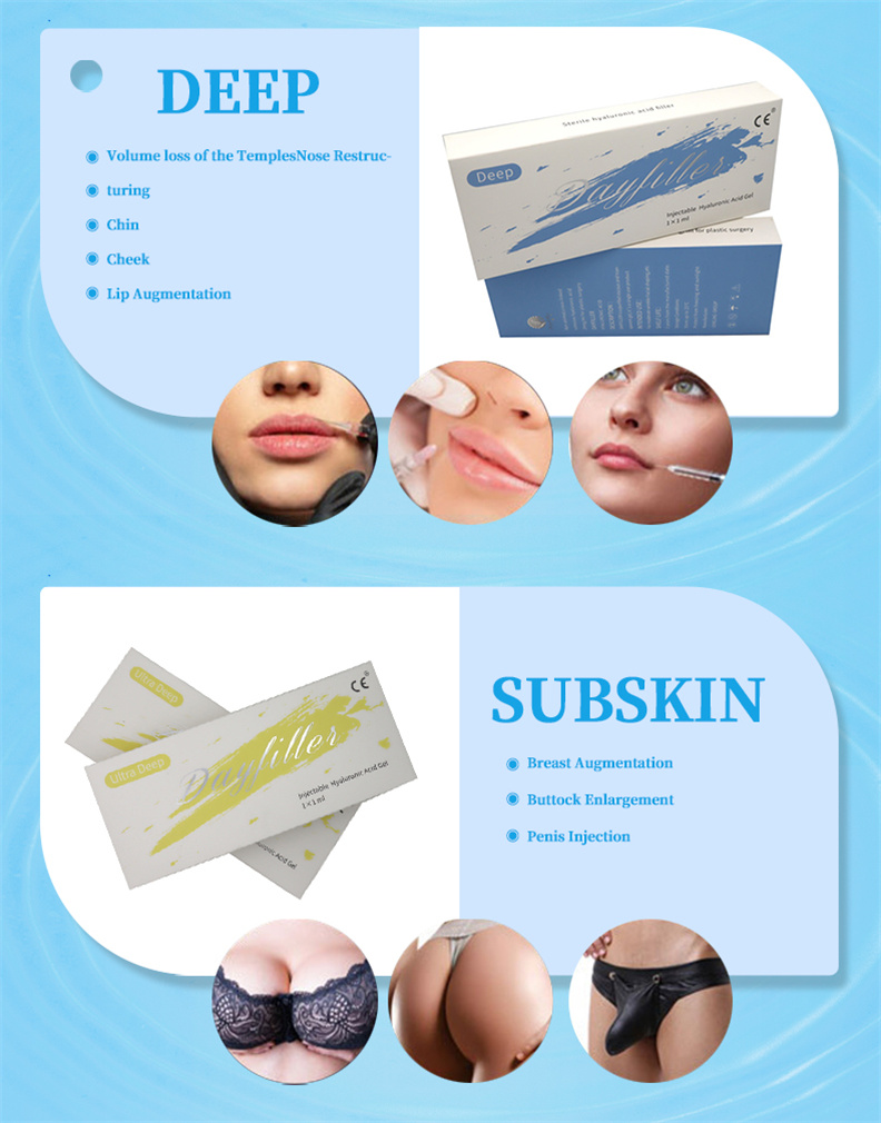 Hyaluronic acid filler 5 Hyaluronic acid filler 5