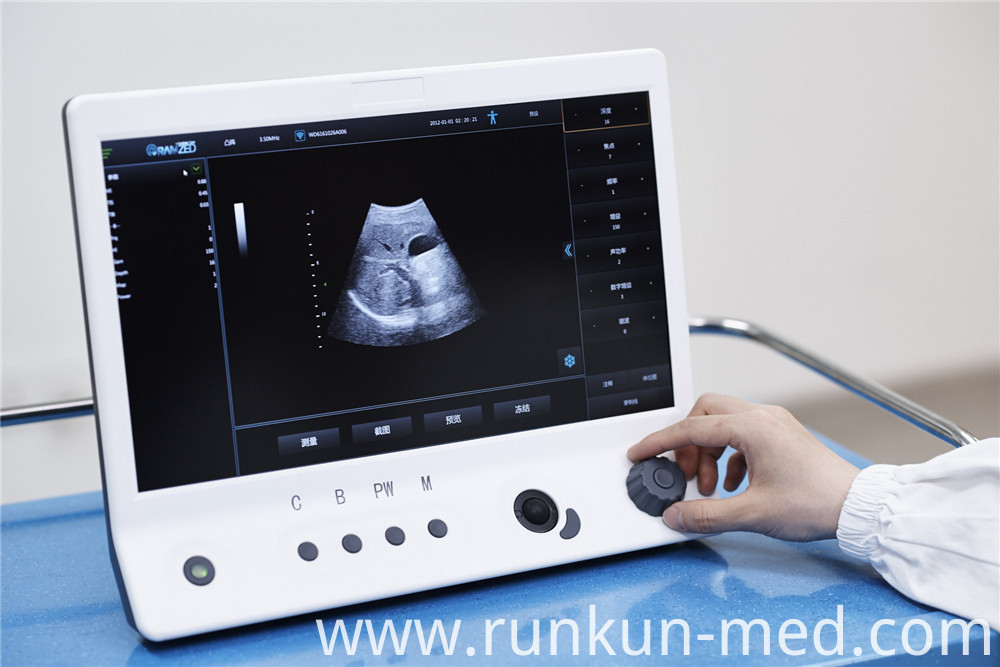 color doppler ultrasound