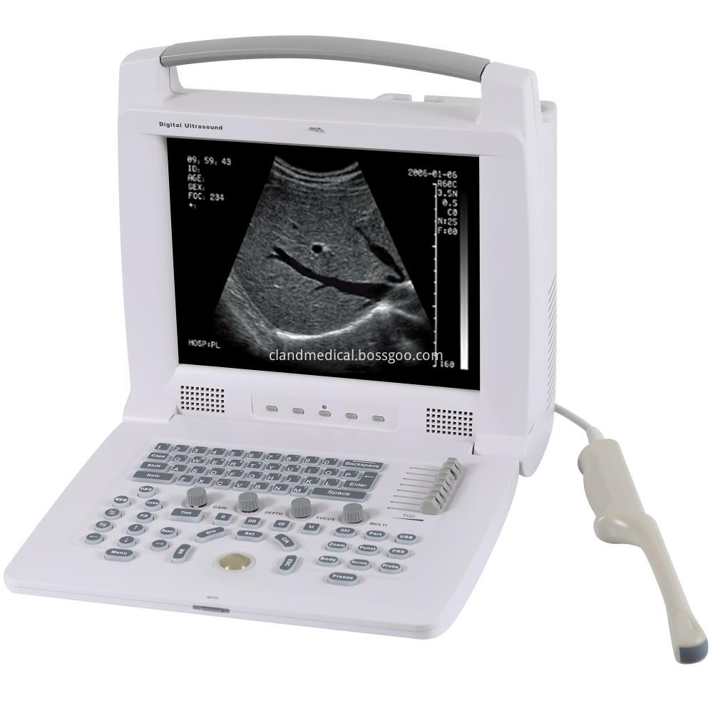 Pl 3018i Full Digital Portable Ultrasound Scanner 11 Pl 3018i Full Digital Portable Ultrasound Scanner 11