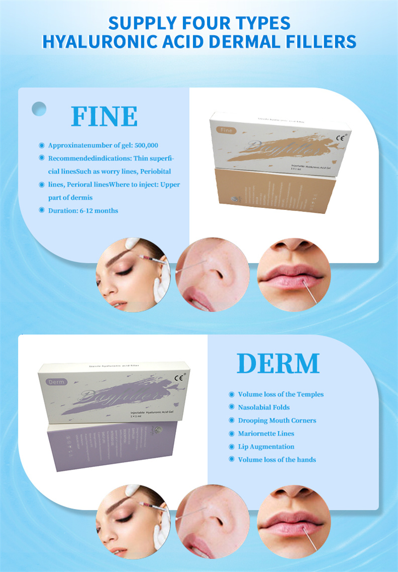 Hyaluronic acid filler 4 Hyaluronic acid filler 4