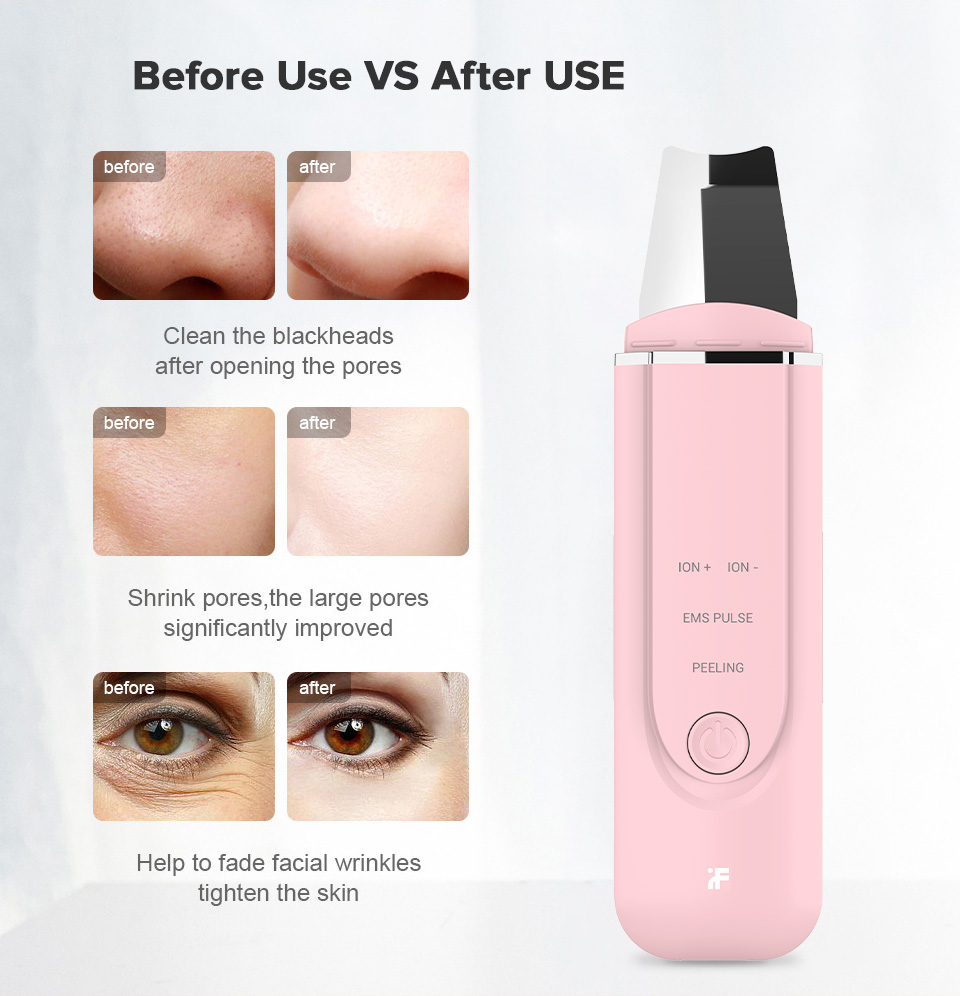 Xiaomi Inface Facial Pore Cleaner Xiaomi Inface Facial Pore Cleaner