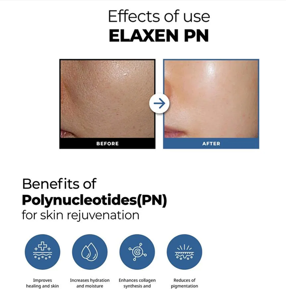 Elaxen pn 4 Elaxen pn 4