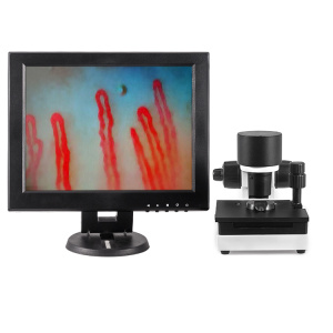 12Inch blood capillary microcirculation microscope