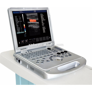New General Laptop Color Doppler Diagnostic Ultrasound Scanner