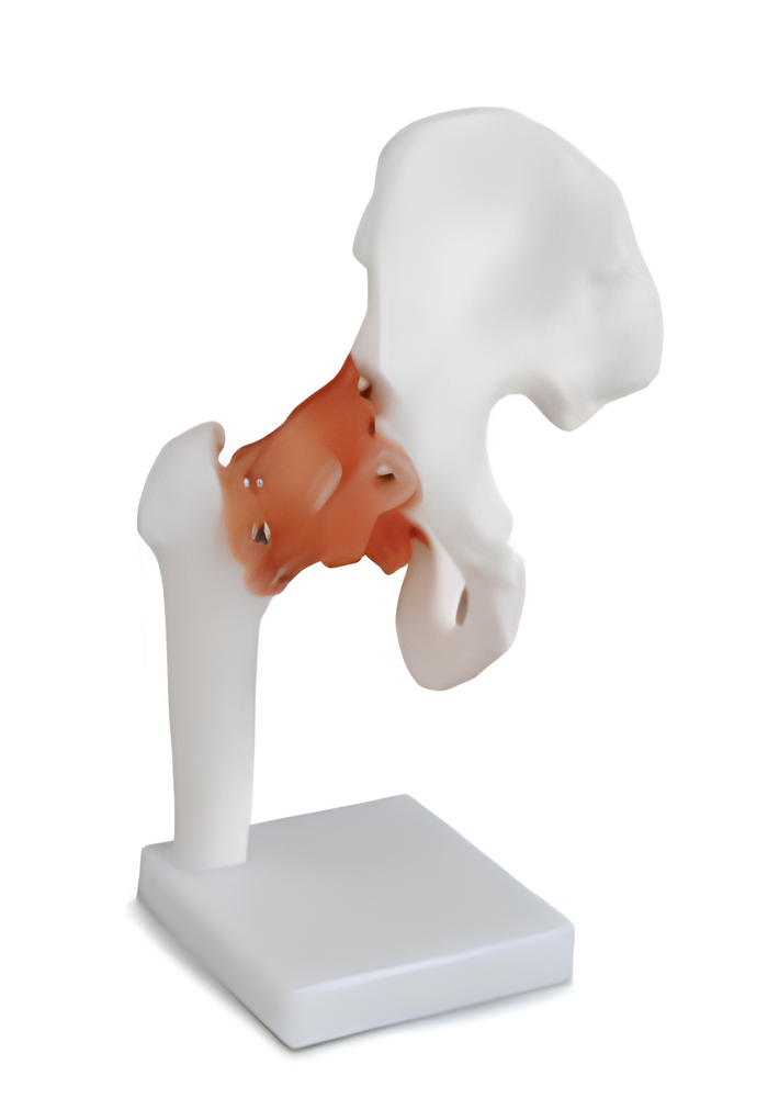 Life-Size Hip Joint Anatomy Model Life-Size Hip Joint Anatomy Model