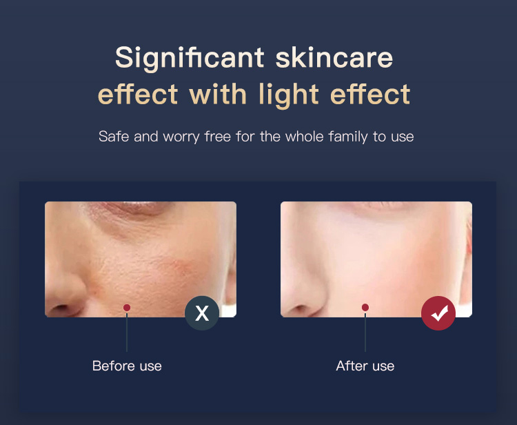 led light therapy mask led light therapy mask