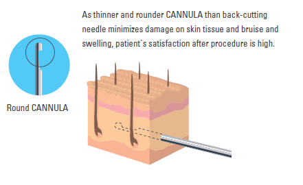 Blunt kanyl Blunt cannula