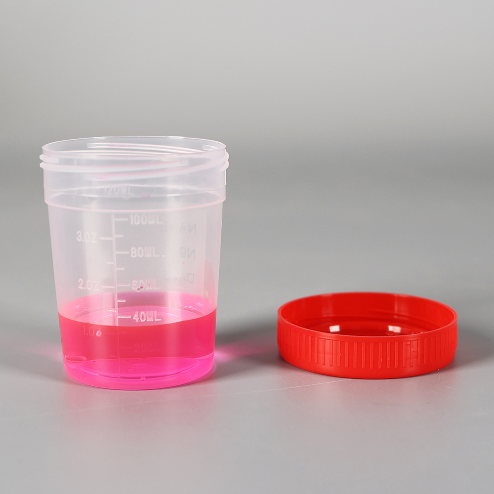 Stool Specimen Container Or Sample Urine Cup