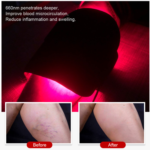 Silicone Infrared Device Red Light Therapy Belt for Sale, Silicone Infrared Device Red Light Therapy Belt wholesale From China