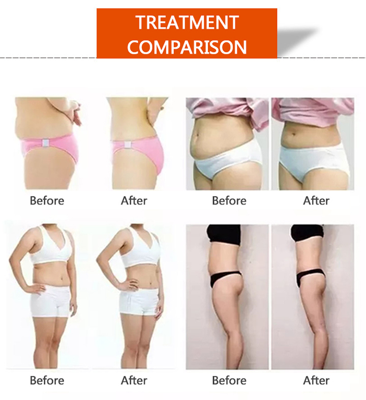 Body Shaping Cavitation RF Slim for Weight Loss Machine