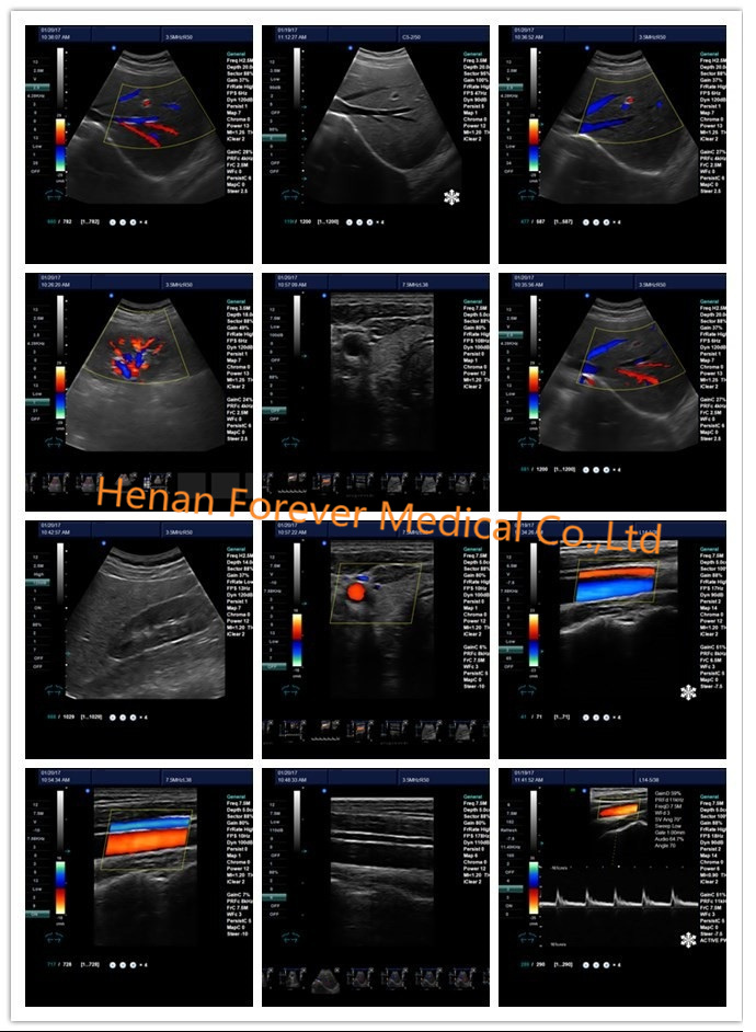 4D Baby Portable Medical Color Doppler Ultrasound Machine