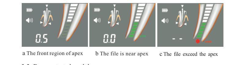 Dental Equipment Apex Locator6 Endodontic Root Canal Finder