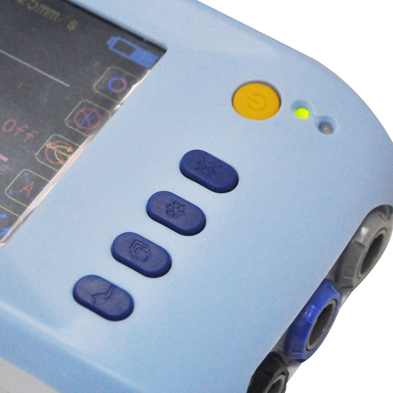 Handheld 6-Parameter Vital Sign Monitor Patient Monitor with Free Software-Alisa
