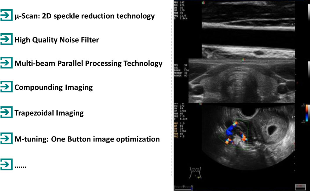 BS-S20 Portable Color Doppler Fetal Ultrasound with High Quality