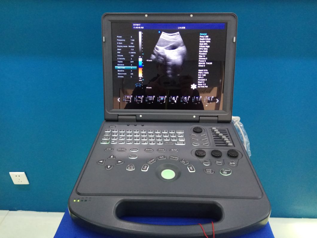 2018 High Precision Digital Beam Forming and Doppler Ultrasound Scanner with Ultrasonic Imaging Technology Mslcu42