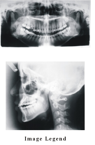 High Quality Oral Panoramic X-ray Unit