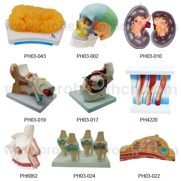 Normal & Pathological 3D plastic Ovary Uterus Anatomical Model