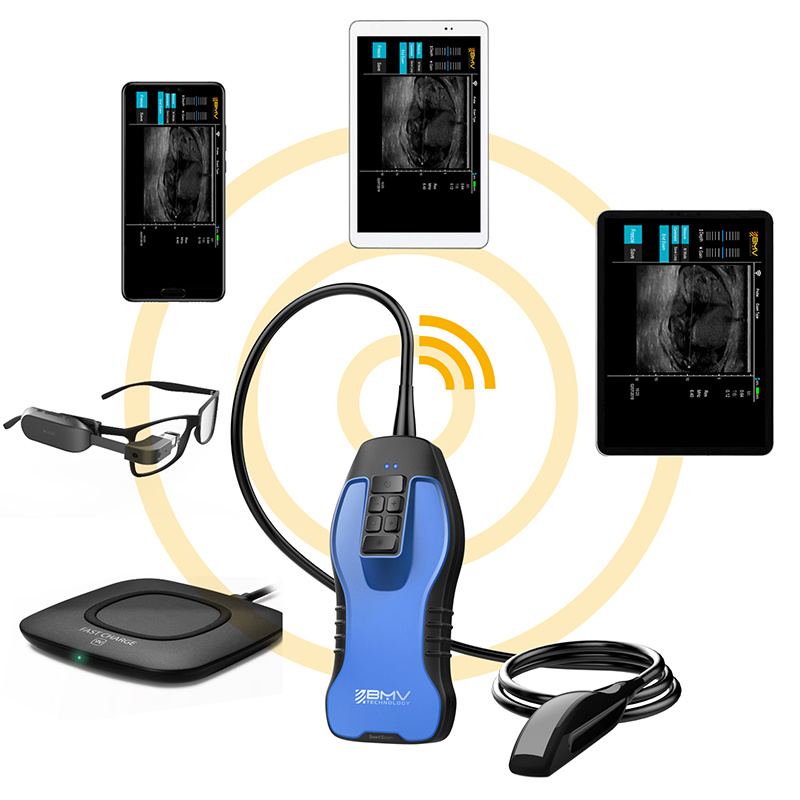 Bestscan S9 IP67 Bovine Scanner Wireless Ultrasound