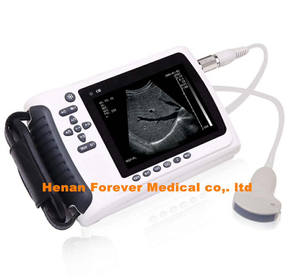 Handheld Veterinary Ultrasound Scanner for Farm and Pet Hospital
