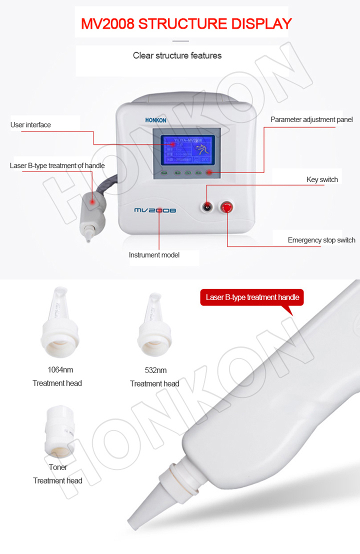 ND YAG Pigmentation 1064nm 532nm Laser Tattoo Removal