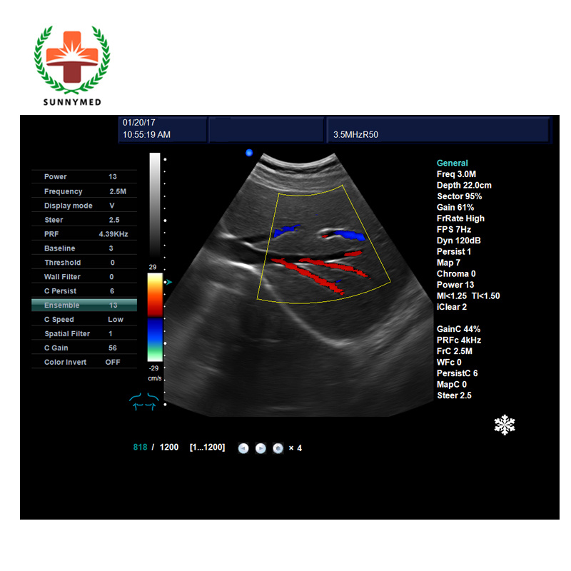 Sya-5t Medical USG Trolley Color Doppler Digital Ultrasound