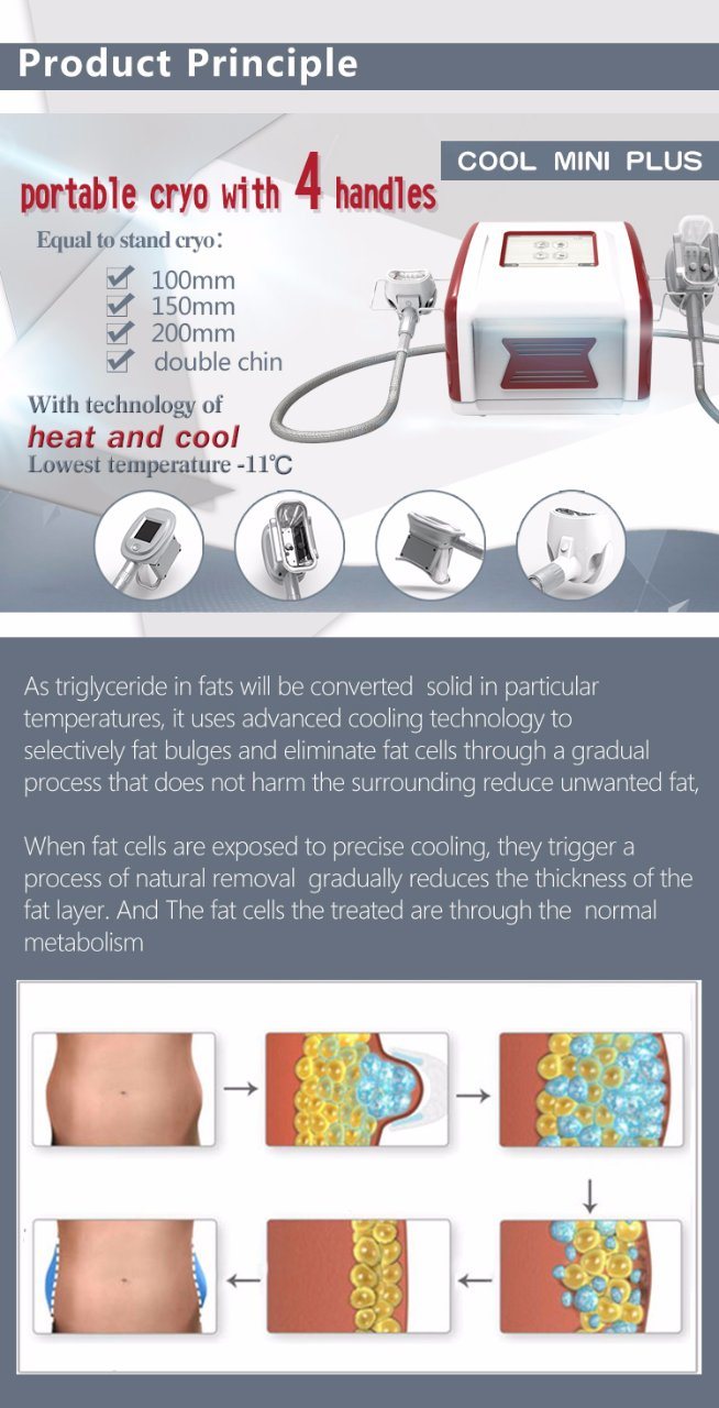 New Portable Slimming Weight Loss Zeltiq Slimming Machine Kryolipolyse Machine