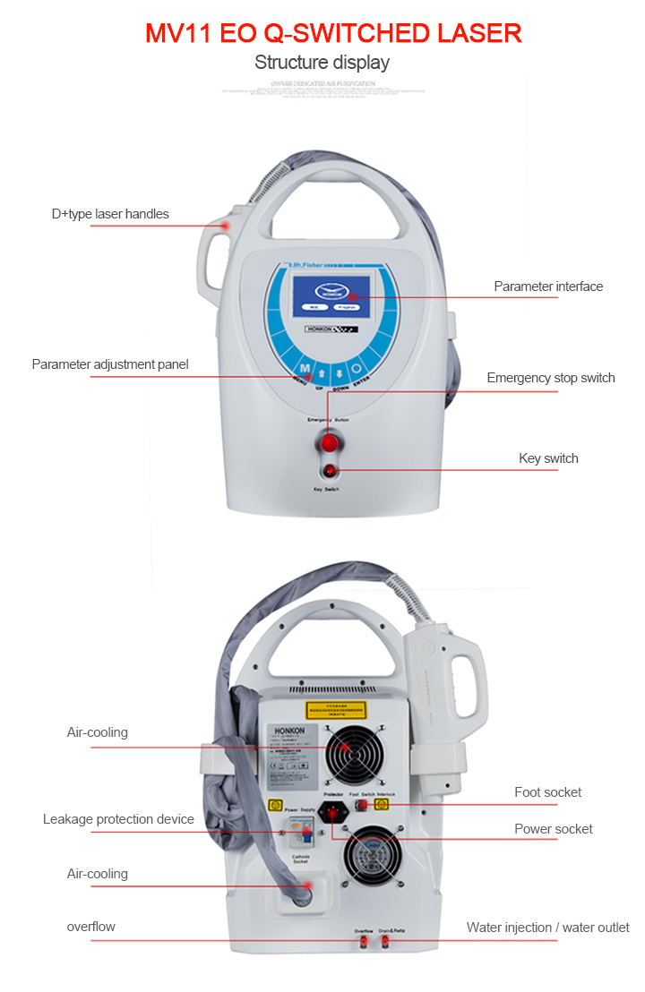 1064nm Freckle Removal Skin Care Spot Removal Equipment