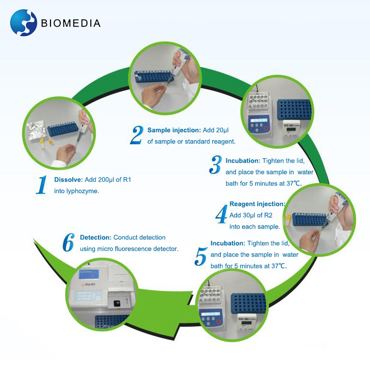 Ivd Homocysteine Rapid Assay Kit/ Test Kit/ Hcy Test Reagent