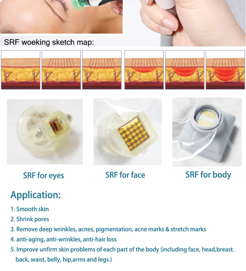 New RF Machine in China Market! Fractional RF Skin Beauty Machine Srf Skin Tighten Cl-02
