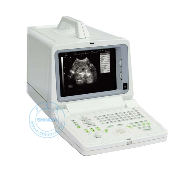 Veterinary Ultrasound Scanner (SonoScan D600V)