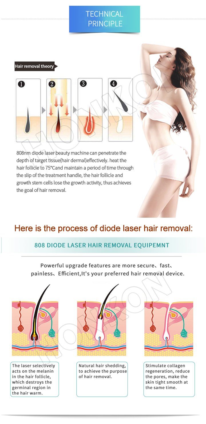 808nm Diode Laser Permanent Professional 808 Hair Removal Machine