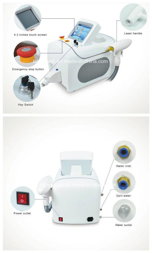 High Power Q-Switch YAG Picosecond Laser Tattoo Removal