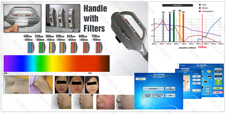 IPL Skin Rejuvenation Beauty Equipment