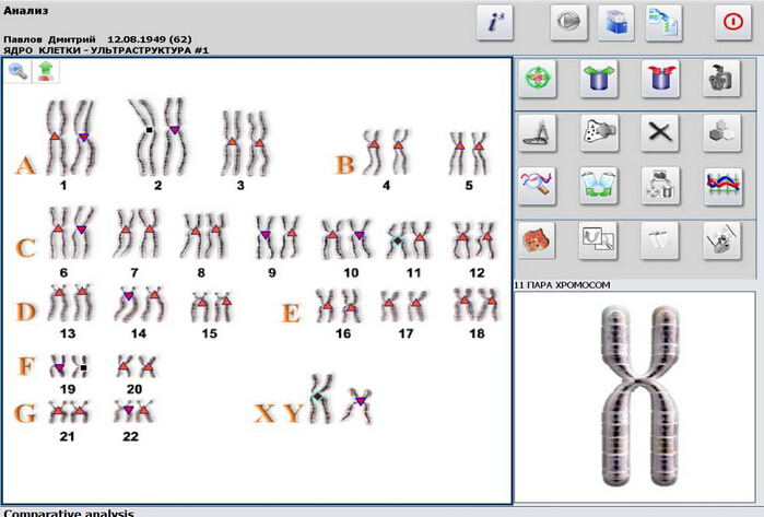 Clinical Diagnostic Metaron Hunter 4025 Nls