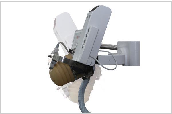 Eswl-Bi Extracorporeal Shock Wave Lithotripter with Ultrasound Scanner Location Function