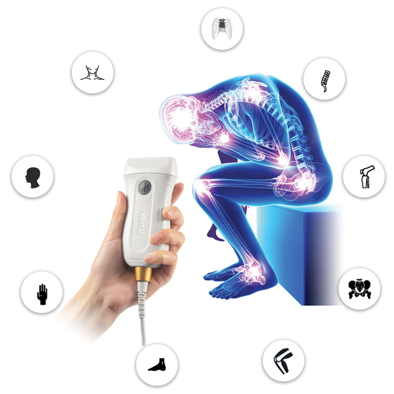 Mx5 Series APP-Based Poc Ultrasound Medical Imaging Scanner