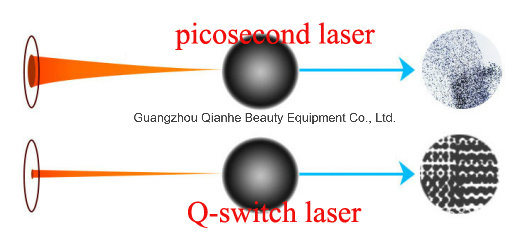 China Wholesale Price Q Switched ND YAG Picosecond Laser Tattoo Pigment Removal Machine