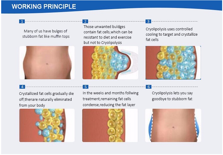 Sincoheren Cryolipolysis Fat Removal Coolsculpting Machine for Body Slimming