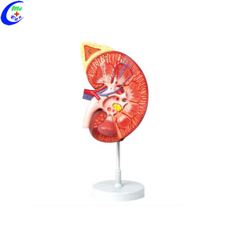 Medical Anatomical Teaching Aids Kidney Educational Model