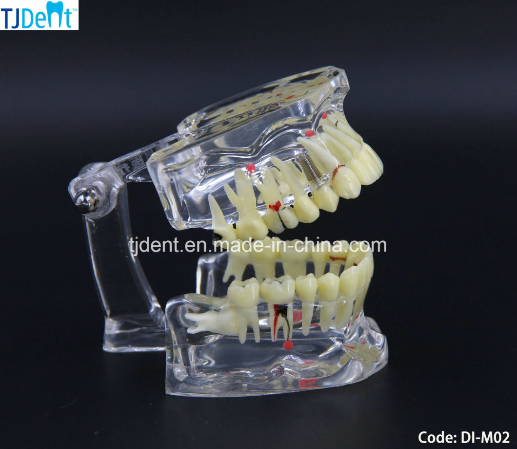 Dental Othodontic Treatment Anatomy Teaching Study Teeth Model (DI-M02)