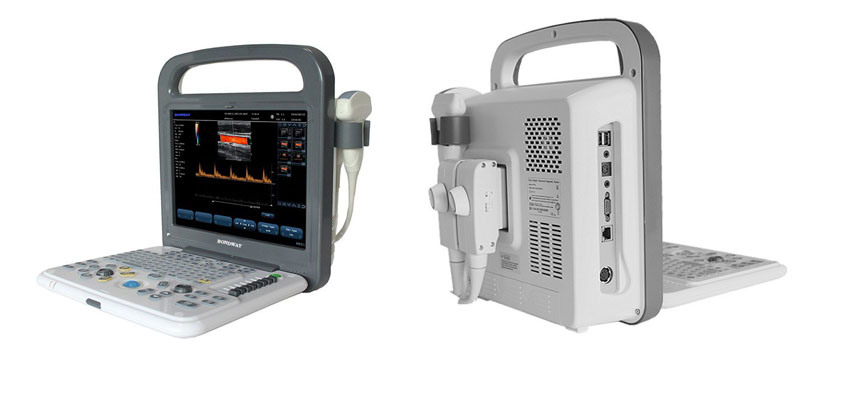 Good Price for Portable Color Doppler Ultrasound Machine, Es240, Ultrasound Portable Fetal Color Doppler