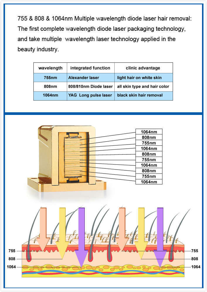 755nm 808nm 1064nm Super Laser Nice Beauty Epilator Diode Laser Hair Removal