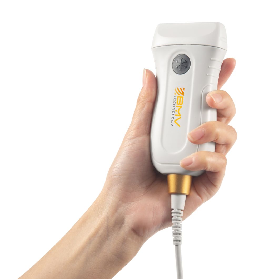 Mx5 Series APP-Based Poc Ultrasound Medical Imaging Scanner