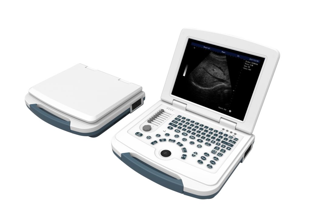 Portable Full Digital Black and White Ultrasound Scanner (AM-580)