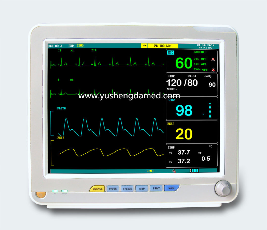 High Quality Medical 12 Inch Multi-Parameter Portable Patient Monitor Ysd16A