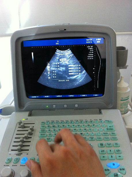Medical Portable Psuedo Color Ultrasound Scanner