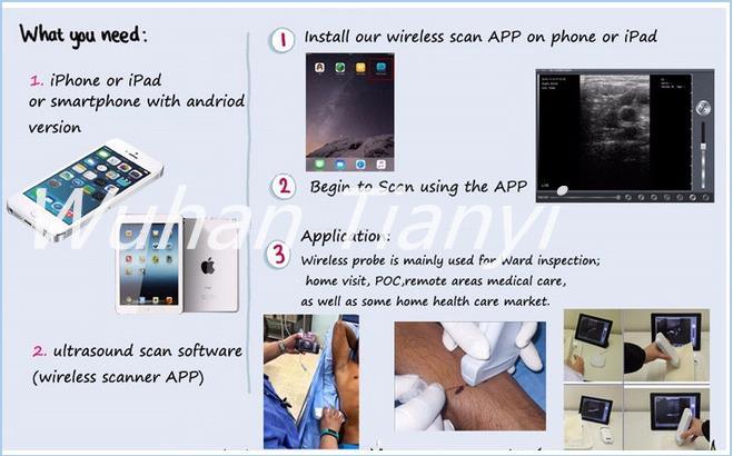 WiFi Portable Ultrasound Diagnosis Equipment for Abdomen/Msk/Vascular Use