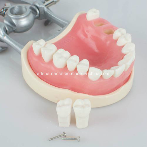 Dental Teach Study Adult Standard Typodont Demonstration Model Teeth